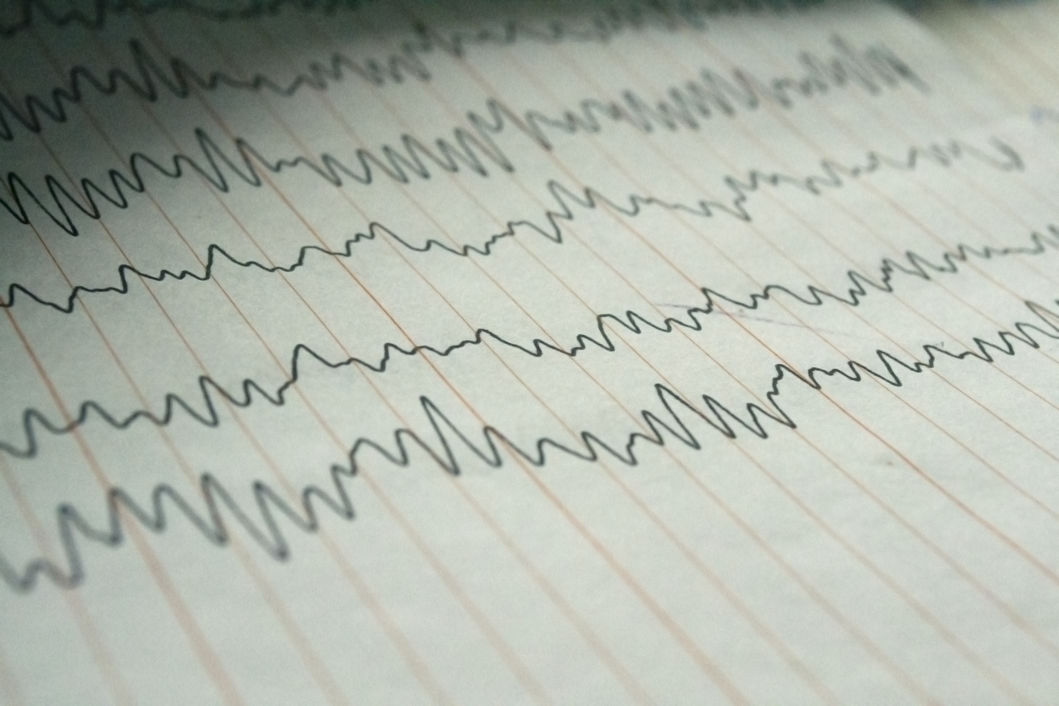 Epilepsy Diagnostics - CentraState Hospital