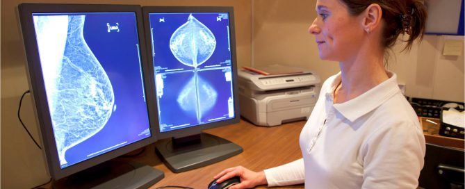 3d Mammogram nj – CentraState Hospital
